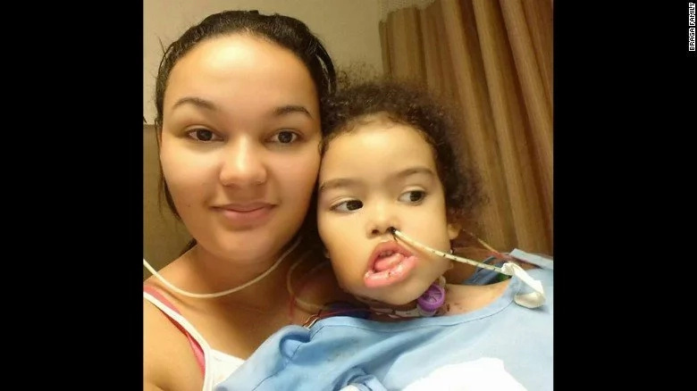 See girl's new face after her jaw was eaten away by a tumour the size of WATERMELON (photos)