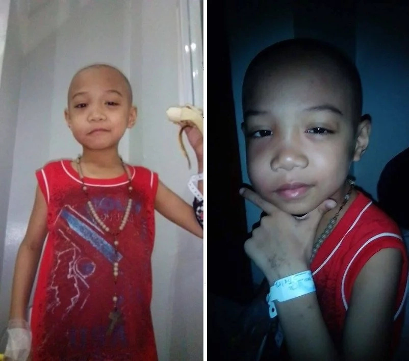 leukemia-patient leukemia-patient