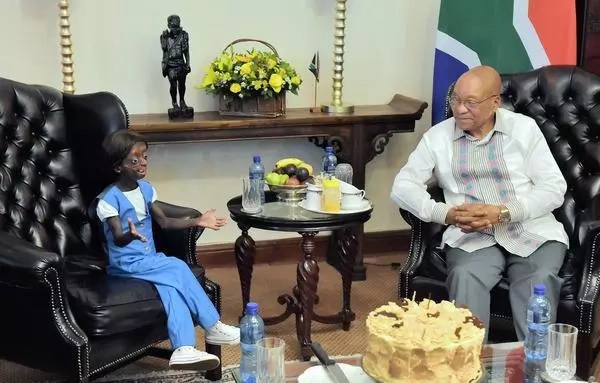Girl trapped in body of aging pensioner celebrates 18th birthday with President (photos, video)