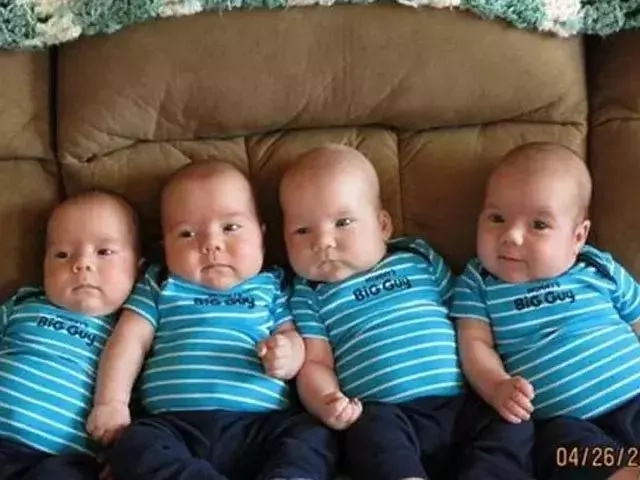 Woman gives birth to 4 babies at once, but they're unusual quadruplets Woman gives birth to 4 babies at once, but they're unusual quadruplets