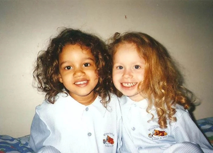 Identical Twins Born With Differenr Skin Colour Identical Twins Born With Differenr Skin Colour