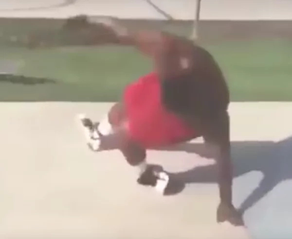 Guy Suffers Horrific ANKLE BREAK In Skateboard Accident