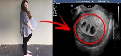 Doctors Advice A Mother To Give Up Her Daughter. Learn This Moving Story Of A Mother's Compelling Love To Her Children.