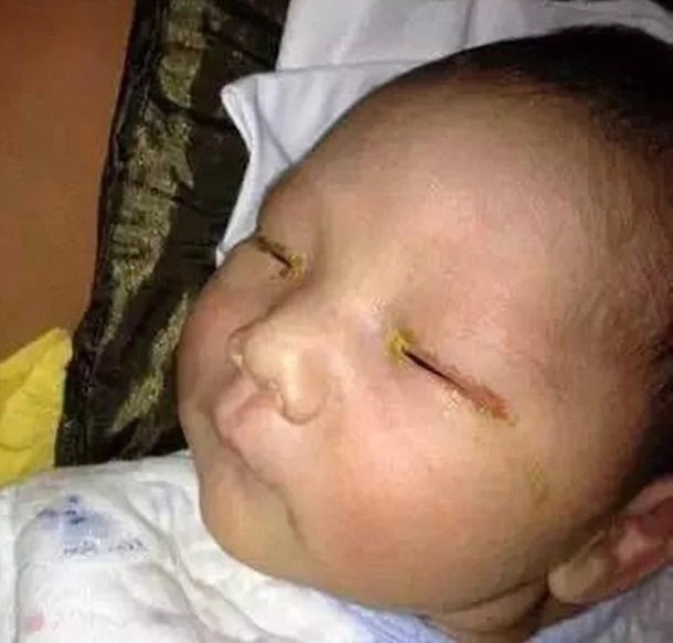 Infant becomes blind after relative snapped a photo with flash Infant becomes blind after relative snapped a photo with flash