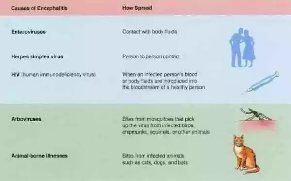 encephalitis encephalitis