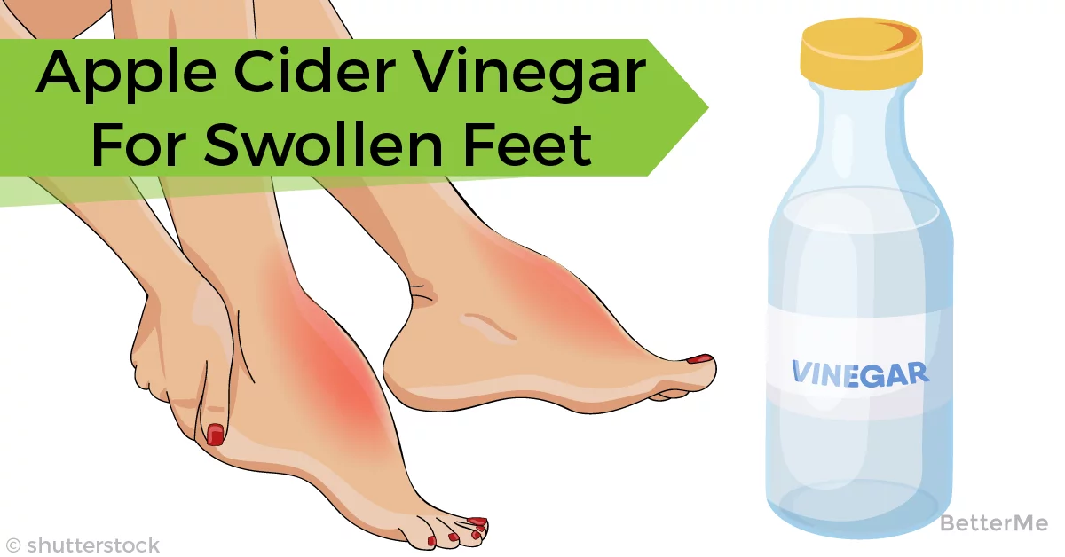 How to treat feet swelling