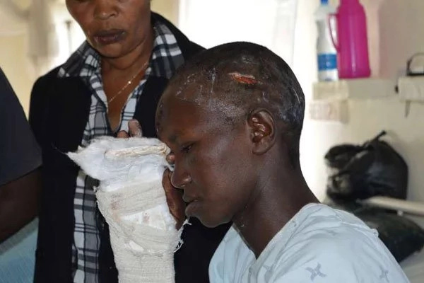 Domestic violence: Man attacks wife with panga in Nyeri