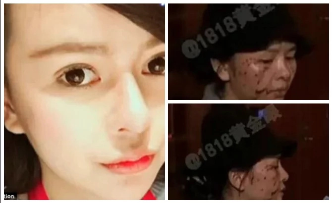 Jealous woman uglify her best friend for being 'too pretty' after undergoing $8,000 plastic surgery (photos) Jealous woman uglify her best friend for being 'too pretty' after undergoing $8,000 plastic surgery (photos)