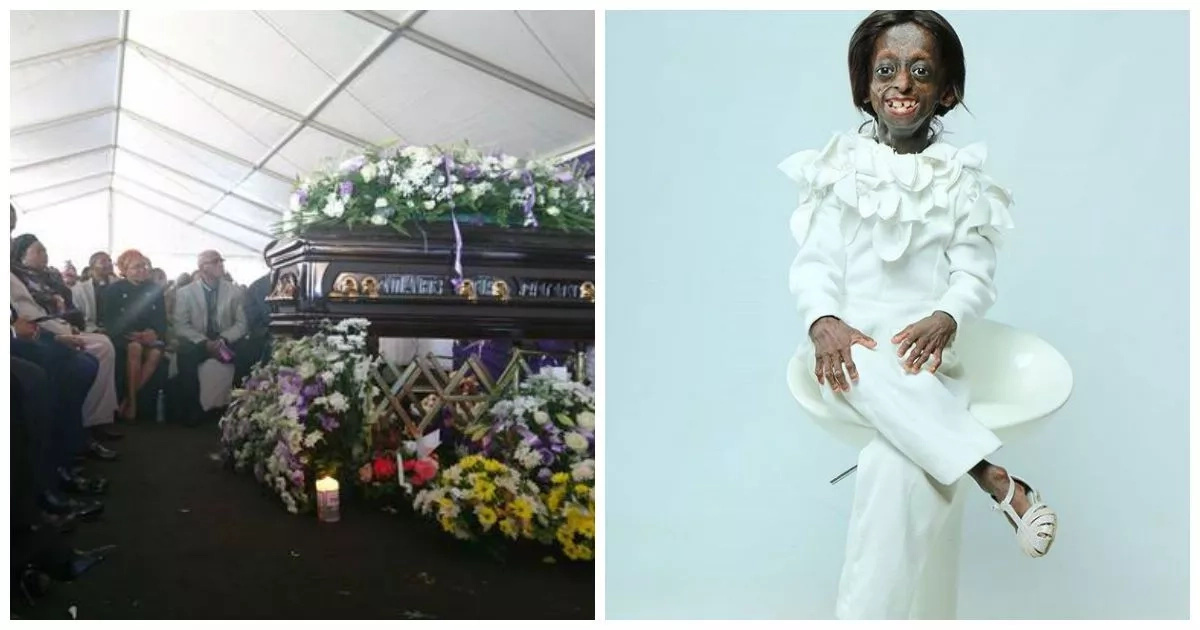 1st black girl diagnosed with progeria who died after 18th birthday is laid to rest 1st black girl diagnosed with progeria who died after 18th birthday is laid to rest