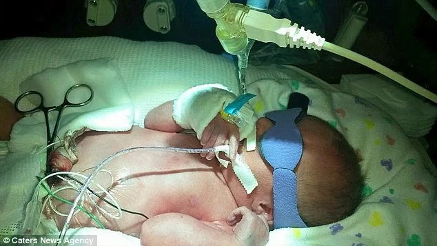 This Baby Could Have Choked To Death On Her Own Tongue, But WATCH What Happened Instead This Baby Could Have Choked To Death On Her Own Tongue, But WATCH What Happened Instead