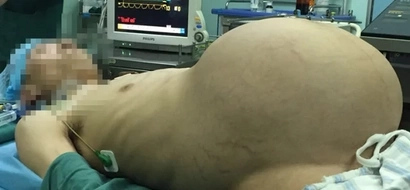 Another 'Pregnant Man' gives birth