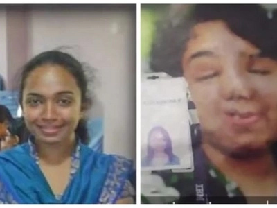 An unlucky car accident ruined her whole face, but this didn't stop her boyfriend to marry her!