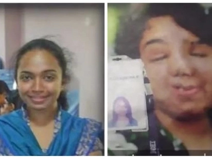 An unlucky car accident ruined her whole face, but this didn't stop her boyfriend to marry her!