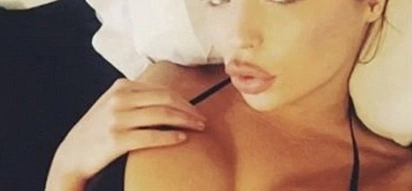 She Spends $35,000 On Plastic Surgery, But Result Is VERY Weird (Photos)