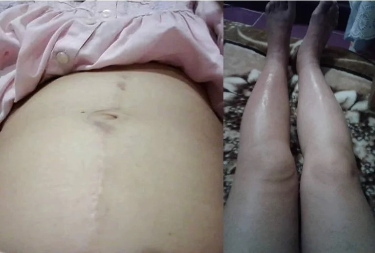 OFW in Kuwait calls help after being abused by employer OFW in Kuwait calls help after being abused by employer