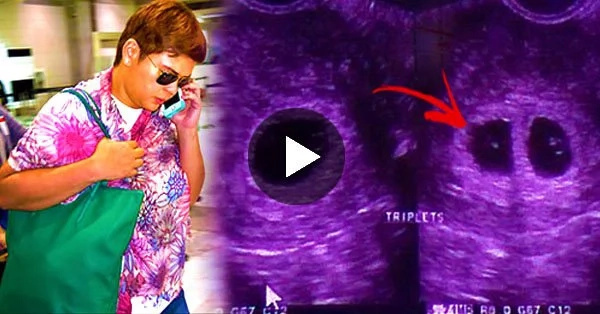 Two of Sara Duterte's triplets have no heartbeat Two of Sara Duterte's triplets have no heartbeat