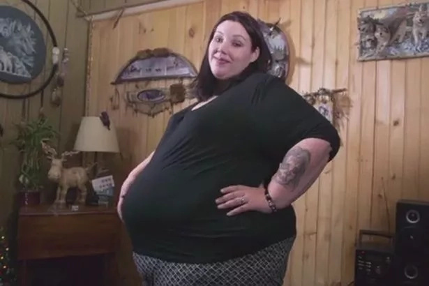 Shocking! Obese Mom Conceives Again After Having Her Fallopian Tubes Tied Shocking! Obese Mom Conceives Again After Having Her Fallopian Tubes Tied