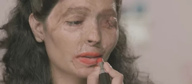 This acid attack victim was invited to walk the catwalk This acid attack victim was invited to walk the catwalk