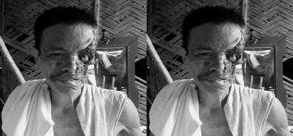 Tatay Gilbert loses half of his FACE but he certainly never loses hope
