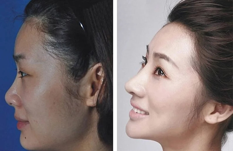 These women tried plastic surgery. The result? Shocking! These women tried plastic surgery. The result? Shocking!