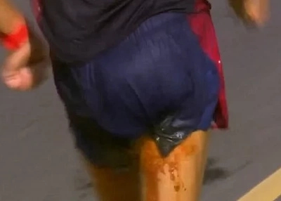 You won’t believe the struggle of this brave French athlete. Find out here!