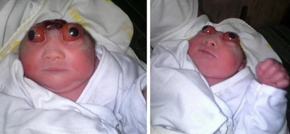 Poor Batangas baby with anencephaly breaks hearts of emotional netizens