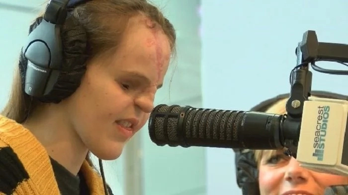 A girl was born without eyes nor nose. Doctors said they've never seen a case like this before! A girl was born without eyes nor nose. Doctors said they've never seen a case like this before!