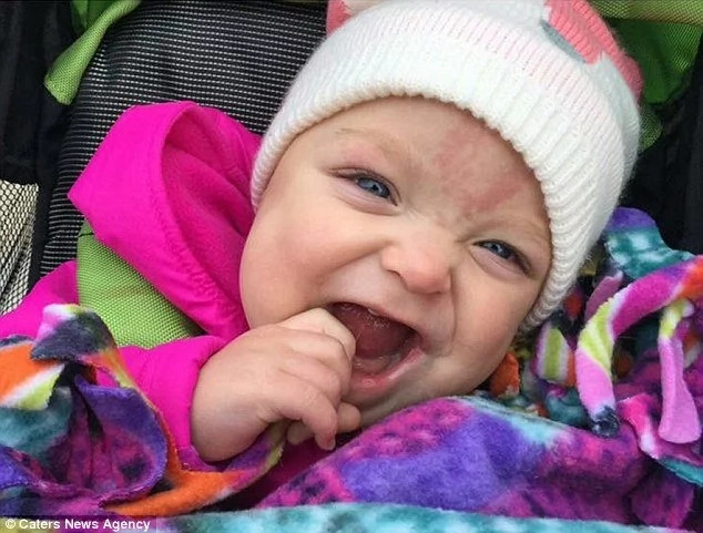 This Baby Could Have Choked To Death On Her Own Tongue, But WATCH What Happened Instead This Baby Could Have Choked To Death On Her Own Tongue, But WATCH What Happened Instead