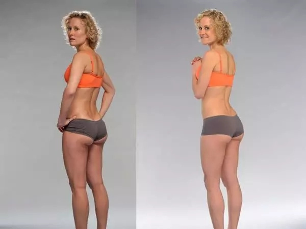 brazilian butt lift workout before and after