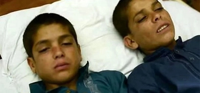 These two brothers undergo mysterious transformation as soon as the sun goes down