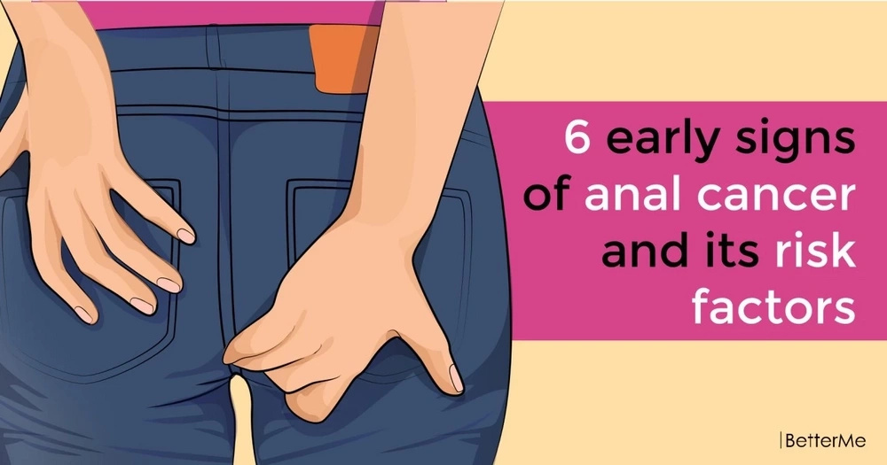 Anal cancer warning signs