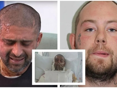 This man and his cousin were hospitalized. The reason was an acid attack from a hateful man!