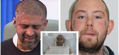 This man and his cousin were hospitalized. The reason was an acid attack from a hateful man!