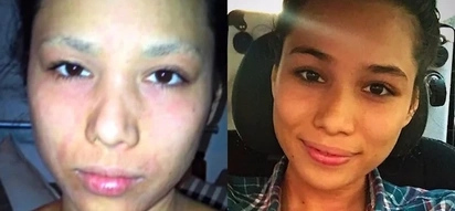 This beauty queen used to have skin problems, but look at her now!