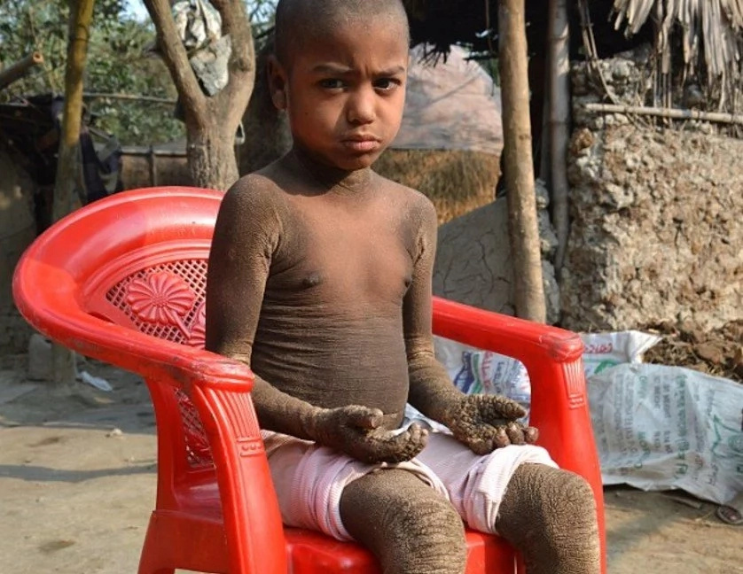 Boy, aged 8, turns into STONE and forced to stay home as kids detest him (photos, video)