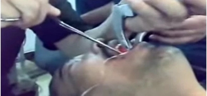 WATCH: Doctors pull a giant wrench out of a man’s throat, you won’t believe how painful it looks!