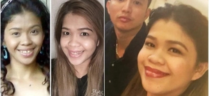Take a look on Melai Cantivero's before and after photos!
