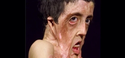 What Surgeon Did To This Girl Makes Her Unrecognizable For Everybody! (Photo)