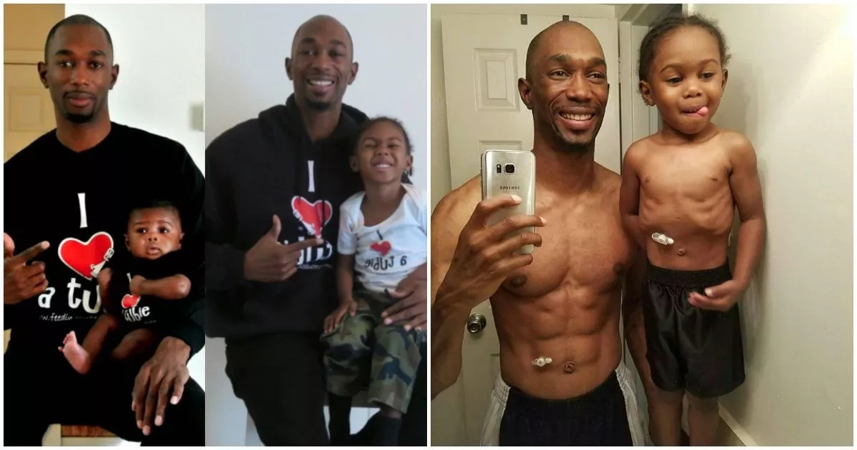 Father shows support for 3-year-old son who eats through his STOMACH (photos, video)
