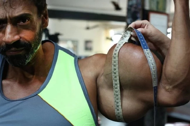 This super brawny man injects oil into his body. You won’t believe the reason This super brawny man injects oil into his body. You won’t believe the reason