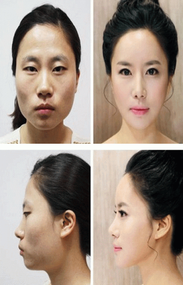 These women tried plastic surgery. The result? Shocking! These women tried plastic surgery. The result? Shocking!