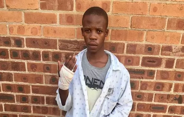 19-year-old student beaten by teacher for not doing HOMEWORK undergoes surgery (photo) 19-year-old student beaten by teacher for not doing HOMEWORK undergoes surgery (photo)