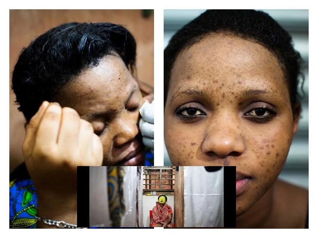 Man threatens his wife with divorce as she refuses to stop bleaching her skin Man threatens his wife with divorce as she refuses to stop bleaching her skin
