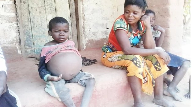 Family pleads for help with boy, 13, whose stomach is constantly expanding and could soon explode Family pleads for help with boy, 13, whose stomach is constantly expanding and could soon explode