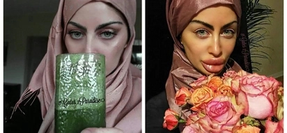 Shocking! This woman might have the largest lips on Instagram (photos)