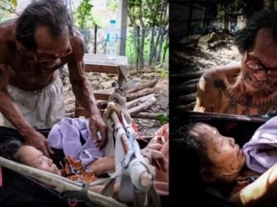 Loving husband starves himself to give enough food to bedridden wife who got bitten by snake