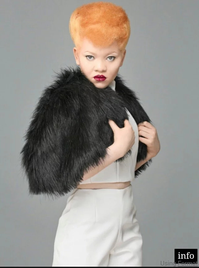 This Kenyan model living with Albinism is redefining beauty