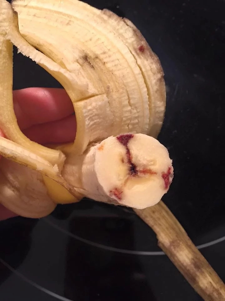 Netizens warned everyone of bananas injected with AIDS and HIV infected blood Netizens warned everyone of bananas injected with AIDS and HIV infected blood