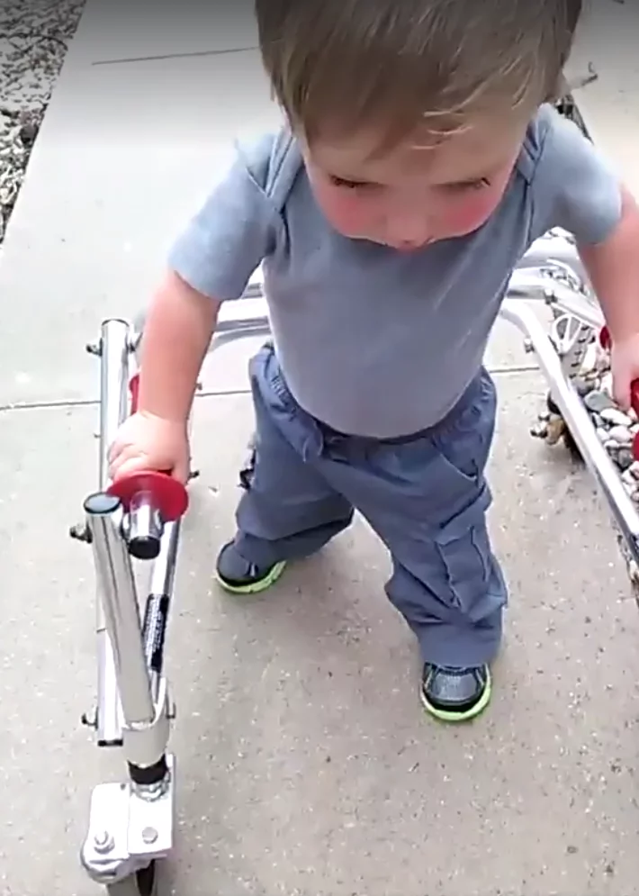 Precious! This sweet and determined two-year-old boy walks unassisted after multiple heart surgeries Precious! This sweet and determined two-year-old boy walks unassisted after multiple heart surgeries