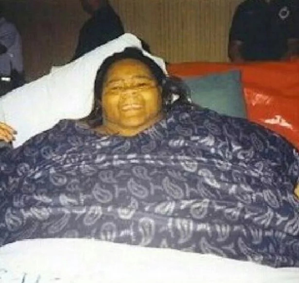 Half Tonne Woman Sheds 230kg After Near Death Experience
